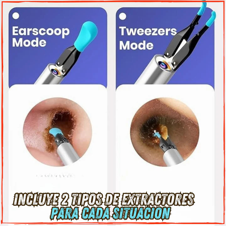 ✅Visualiza y Elimina todo el Sucio de tus Oidos👍Con Camara Full HD y Accesorios de Extraccion Sencibles(💥Pagas al Recibirlo+Envio Gratis💥).