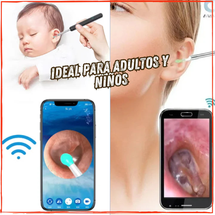 ✅Visualiza y Elimina todo el Sucio de tus Oidos👍Con Camara Full HD y Accesorios de Extraccion Sencibles(💥Pagas al Recibirlo+Envio Gratis💥).